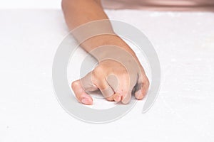 Disabled person hand without fingers since childhood brith, no thumb nail on white background . Woman hands handicap show