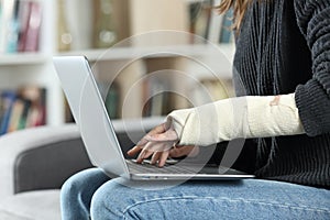 Disabled woman with bandaged arm using laptop