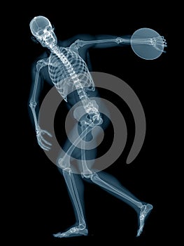 A discus thrower x-ray