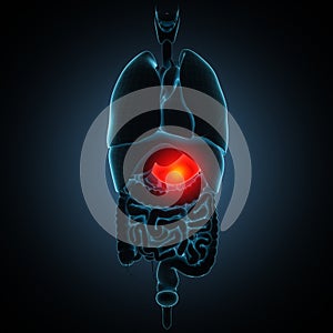 Disease illustration of human stomach