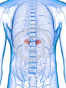 Diseased adrenal glands