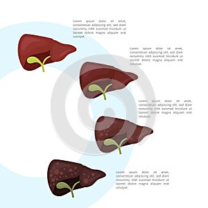 Diseases of the liver