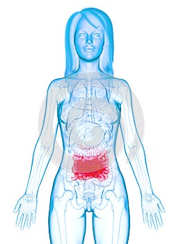 A diseases small intestine