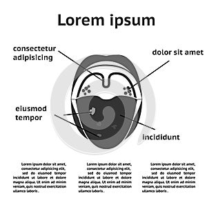 Diseases of the throat and oral cavity