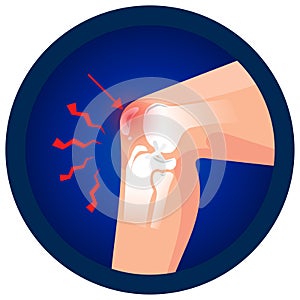 Dislocated knee cap icon. Vector flat design for radiology orthopedic research hospital for body joints