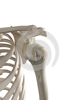 a dislocated shoulder