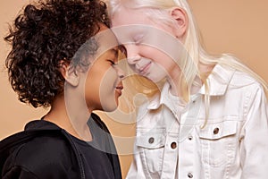 Diverse black and albino kids in love