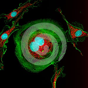 Dividing fibroblast cell