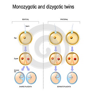 Dizygotic And Monozygotic Twins