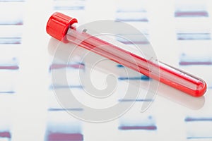 DNA blood sample