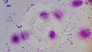 DNA Fragmentation Test in Human spermatozoid Halosperm photo