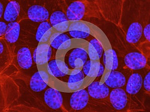 The DNA of human embryonic stem cells stained in blue with fluorescent dye