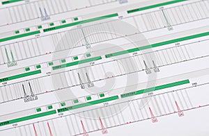 DNA Profile - Genetic Fingerprint