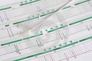 DNA Profile - Genetic Fingerprint