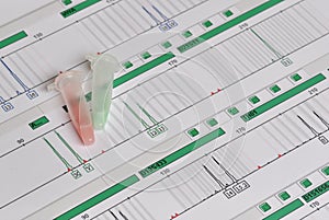 DNA Profile - Genetic Fingerprint