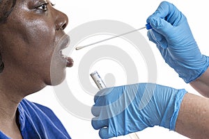 DNA swab of saliva taken from blacl woman photo