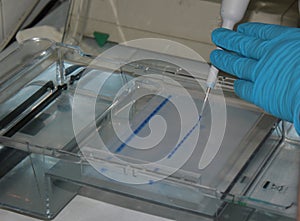 DNA test in agarose gel