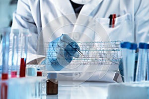 Doctor analyzing DNA sequence results analysis graph