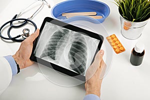 Doctor analyzing patient lung x-ray results on digital tablet