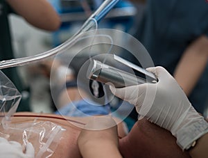 Doctor apply laryngoscope for endotracheal intubation