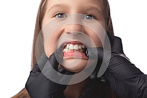 A doctor in black medical gloves examines the oral cavity of a little cute girl. Crooked teeth. Studio photo on a white background