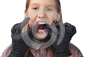 A doctor in black medical gloves tries on an orthodontic appliance for a little girl. The concept of teeth alignment in childhood