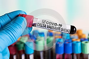 Doctor with a blood sample with a new Indian variant of Coronavirus strain called DELTA