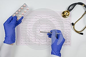 A doctor in blue gloves holds an ECG with rhythm disturbance and extrasystole in his hands.