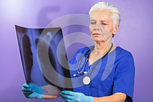 A doctor in blue nitrile gloves and a stethoscope examining chest x-ray