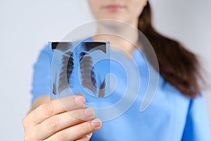 A doctor in a blue uniform shows a picture of a fluorogram of fluorography, an X-ray of the lungs for the prevention and