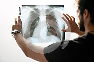 Doctor checking examining chest x-ray film of patient on white background , Corona virus concept.