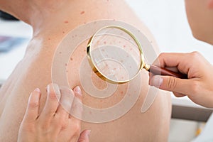 Doctor Checking Skin Of Patient With Magnifying Glass