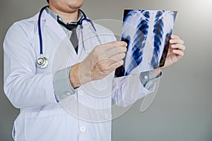 Doctor consulting with patient presenting results on x-ray film About the problem of the patient cover-19 virus photo