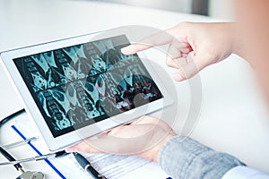 Doctor consulting with patient presenting x-ray film results on digital tablet tablet sitting at table