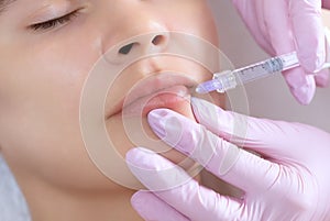 The doctor cosmetologist makes Lip augmentation procedure of a beautiful woman in a beauty salon