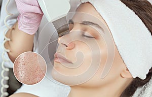 The doctor-cosmetologist makes the ultrasound cleaning procedure of the facial skin of a beautiful, young woman in a beauty salon