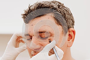 Doctor Cosmetologist prepares man's face for botox injections, rejuvenation procedure, applies dots, in spa beauty photo