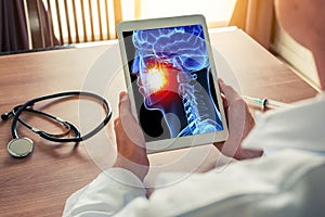 Doctor or dentist holding a digital tablet with x-ray of 3D skull with pain on the teeth. Headache migraine or trauma concept.
