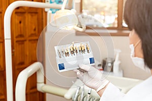 Doctor dentist woman holding tooth shade guide at clinic