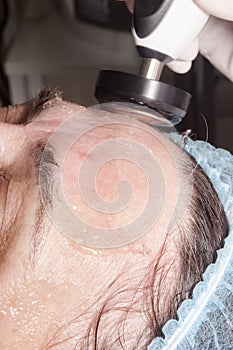 Doctor dermatologist performs face radio lift to rejuvenate skin