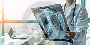 Doctor diagnosing patientÃ¢â¬â¢s health on asthma, lung disease, COVID-19 or bone cancer illness with radiological chest x-ray film photo