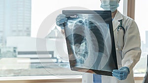 Doctor diagnosing patientÃ¢â¬â¢s health on asthma, lung disease, COVID-19 or bone cancer illness with radiological chest x-ray film photo