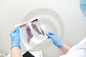 Doctor diagnosing patients health on asthma, lung disease, COVID-19, coronavirus  illness with radiological chest x-ray film for