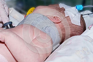 Doctor doing auscultation newborn baby with peripheral intravenous catheter and orthopedic collar in neonatal intensive care unit