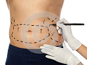 Doctor drawing marks on man`s body for cosmetic surgery operation against white background