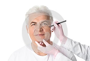 Doctor drawing marks on mature man`s face for cosmetic surgery operation