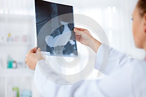 Doctor examine an x-ray picture