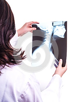 Doctor examine X ray of shoulder, neck and Jaw