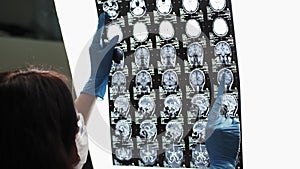 Doctor examines an MRI image of patient`s brain.