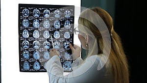 Doctor examines MRI scan of a patient attentively